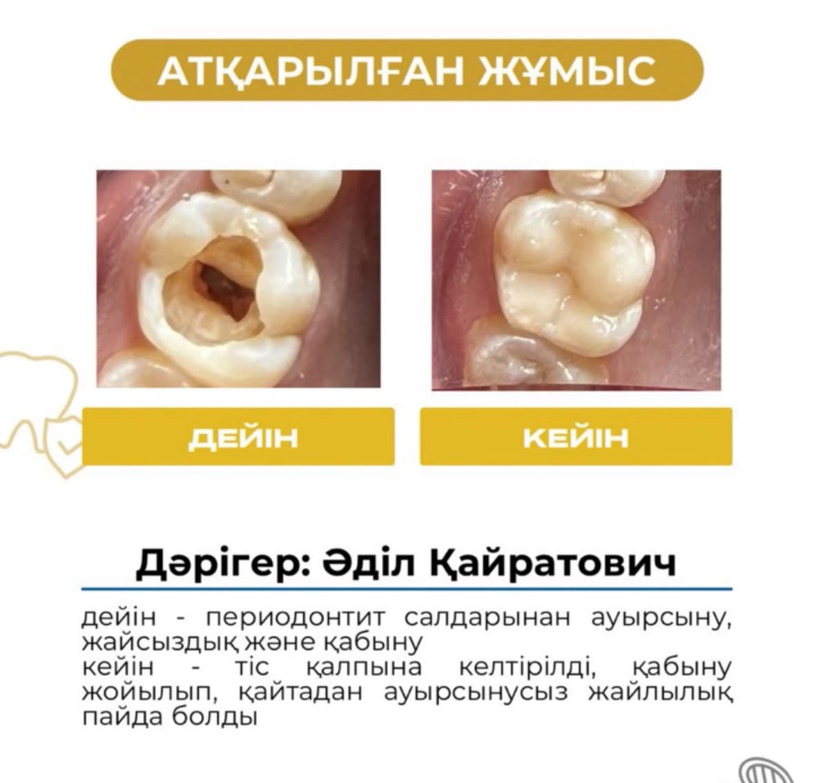 Работа до и после: лечение периодонтита